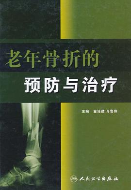 老年骨折的预防与治疗 pdf epub mobi 电子书 下载