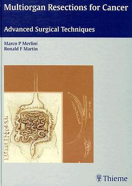 Multiorgan Resections for Cancer pdf epub mobi 电子书 下载