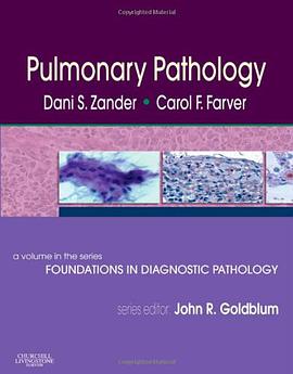Pulmonary Pathology pdf epub mobi 电子书 下载