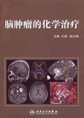 脑肿瘤的化学治疗 pdf epub mobi 电子书 下载
