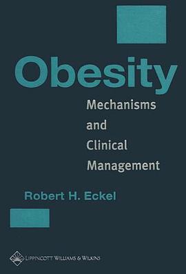 Obesity