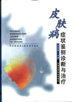 皮肤病症状鉴别诊断与治疗 pdf epub mobi 电子书 下载