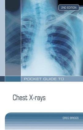 Pocket Guide to Chest X-rays pdf epub mobi 电子书 下载