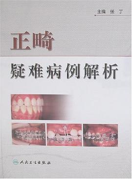 正畸疑難病例解析 pdf epub mobi 電子書 下載