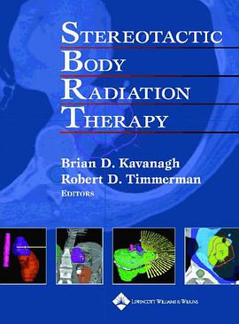Stereotactic Body Radiation Therapy pdf epub mobi 电子书 下载