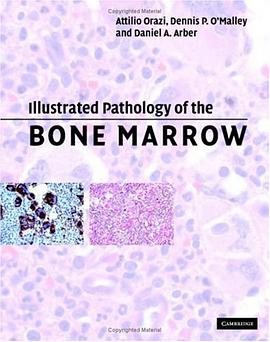 Illustrated Pathology of the Bone Marrow pdf epub mobi 电子书 下载