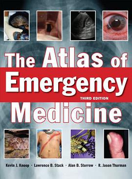 The Atlas of Emergency Medicine pdf epub mobi 电子书 下载