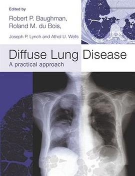 Diffuse Lung Disease pdf epub mobi 电子书 下载