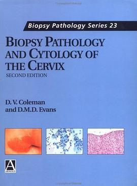 Biopsy Pathology and Cytology of the Cervix (Access to History) pdf epub mobi 电子书 下载