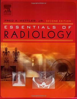 Essentials of Radiology pdf epub mobi 电子书 下载