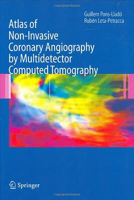 Atlas of Non Invasive Coronary Angiography by Multidetector Computed Tomography pdf epub mobi 电子书 下载