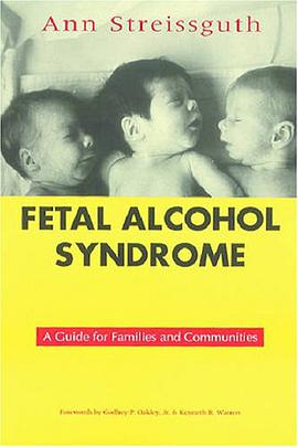 Fetal Alcohol Syndrome