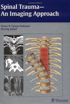 Spinal Trauma pdf epub mobi 电子书 下载