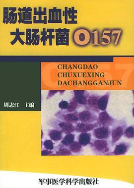 肠道出血性大肠杆菌O157 pdf epub mobi 电子书 下载
