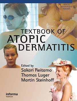 Textbook of Atopic Dermatitis pdf epub mobi 电子书 下载