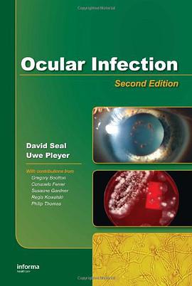 Ocular Infection pdf epub mobi 电子书 下载