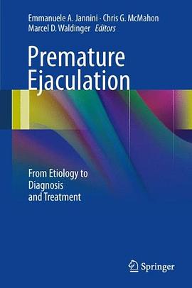 Premature Ejaculation pdf epub mobi 电子书 下载