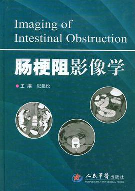肠梗阻影像学 pdf epub mobi 电子书 下载