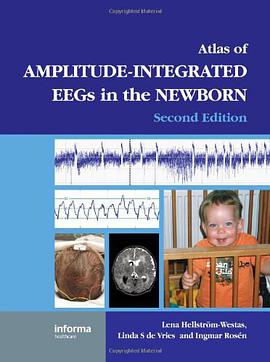 Atlas of Amplitude-Integrated EEGS in the Newborn pdf epub mobi 电子书 下载