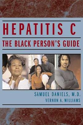 Hepatitis C pdf epub mobi 电子书 下载