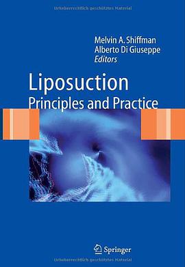 Liposuction pdf epub mobi 电子书 下载