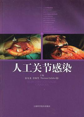 人工关节感染 pdf epub mobi 电子书 下载