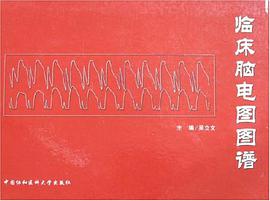 临床脑电图图谱 pdf epub mobi 电子书 下载