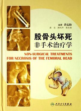 股骨头坏死非手术治疗学 pdf epub mobi 电子书 下载