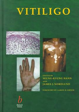 Vitiligo pdf epub mobi 电子书 下载