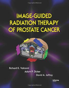 Image-Guided Radiation Therapy of Prostate Cancer pdf epub mobi 电子书 下载
