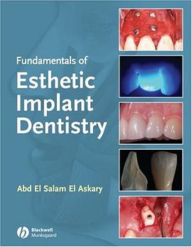 Fundamentals of Esthetic Implant Dentistry pdf epub mobi 电子书 下载