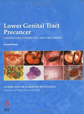 Lower Genital Tract Precancer pdf epub mobi 电子书 下载