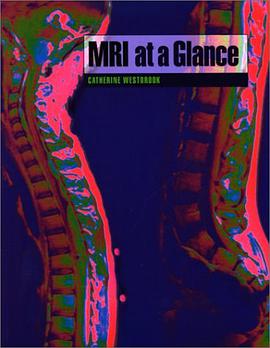 MRI at a Glance pdf epub mobi 電子書 下載