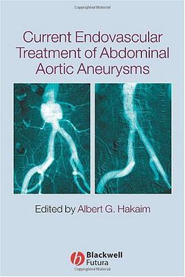 Current Endovascular Treatment of Abdominal Aortic Aneurysms最新腹主动脉瘤血管内治疗术 pdf epub mobi 电子书 下载