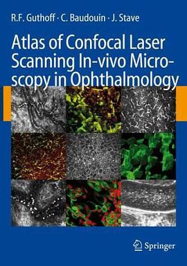 Atlas of Confocal Laser Scanning In-vivo Microscopy in Ophthalmology pdf epub mobi 电子书 下载