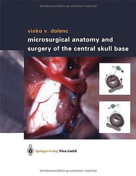 Microsurgical Anatomy and Surgery of the Central Skull Base