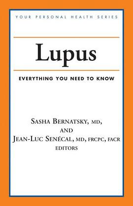 Lupus pdf epub mobi 电子书 下载