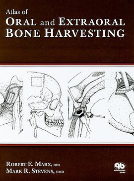Atlas of Oral and Extraoral Bone Harvesting pdf epub mobi 电子书 下载