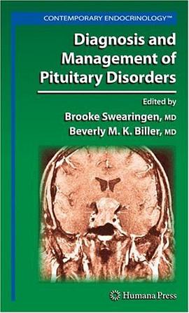 Diagnosis and Management of Pituitary Disorders (Contemporary Endocrinology) pdf epub mobi 电子书 下载