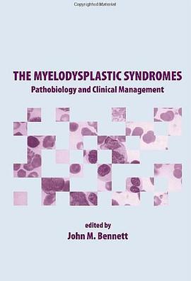 The Myelodysplastic Syndromes pdf epub mobi 电子书 下载