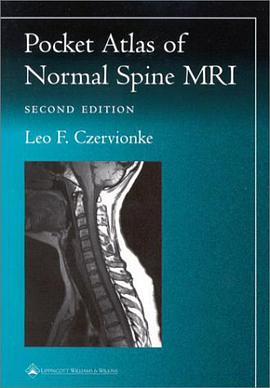Pocket Atlas of Spinal MRI pdf epub mobi 電子書 下載