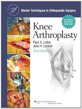 Master Techniques in Orthopaedic Surgery pdf epub mobi 電子書 下載