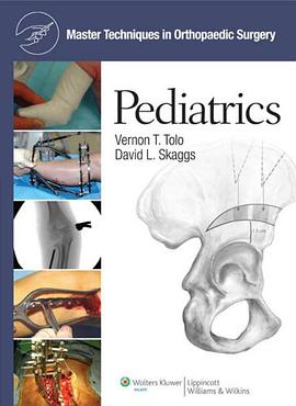 Master Techniques in Orthopaedic Surgery pdf epub mobi 电子书 下载