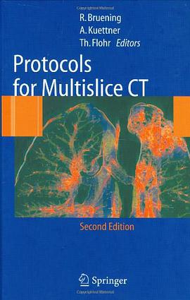 Protocols for Multislice CT pdf epub mobi 电子书 下载