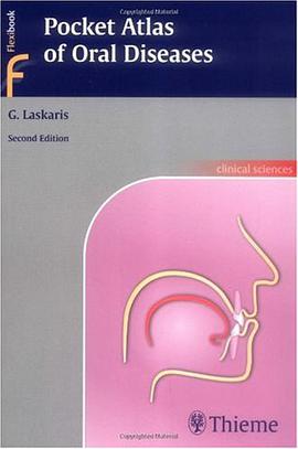Pocket Atlas of Oral Diseases pdf epub mobi 电子书 下载