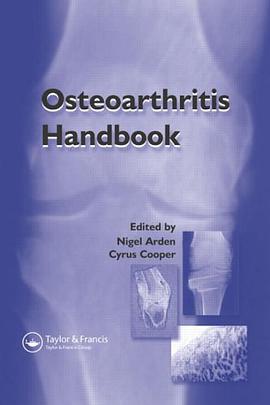 Osteoarthritis Handbook pdf epub mobi 电子书 下载