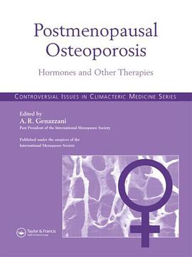 Postmenopausal Osteoporosis pdf epub mobi 电子书 下载