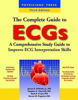 The Complete Guide to ECGs pdf epub mobi 电子书 下载