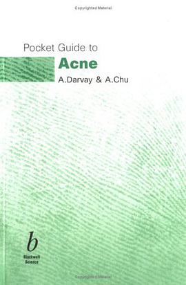 Pocket Guide to Acne pdf epub mobi 电子书 下载