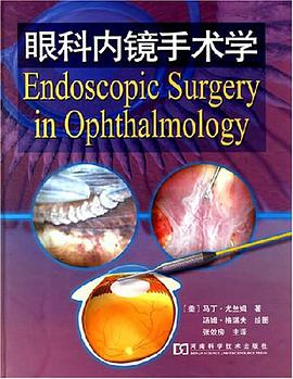 眼科内镜手术学 pdf epub mobi 下载